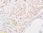 IL-17 Antibody in Immunohistochemistry (Paraffin) (IHC (P))