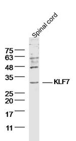 KLF7 Antibody in Western Blot (WB)