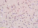 KMT2H/ASH1L Antibody in Immunohistochemistry (Paraffin) (IHC (P))