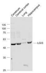 LGI3 Antibody in Western Blot (WB)