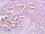 FRA2 Antibody in Immunohistochemistry (Paraffin) (IHC (P))