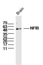 NFIB/NF1B2 Antibody in Western Blot (WB)