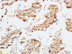 ECE1 Antibody in Immunohistochemistry (Paraffin) (IHC (P))