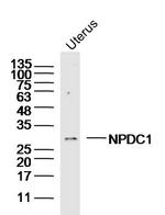 NPDC1 Antibody in Western Blot (WB)