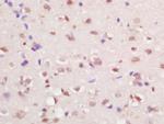 RFX4 Antibody in Immunohistochemistry (Paraffin) (IHC (P))