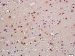 SATB2 Antibody in Immunohistochemistry (Paraffin) (IHC (P))