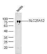 SLC25A12/ARALAR Antibody in Western Blot (WB)