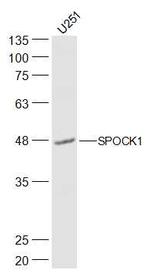 SPOCK1/Testican 1 Antibody in Western Blot (WB)