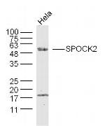 SPOCK2/Testican 2 Antibody in Western Blot (WB)