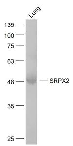 SRPX2 Antibody in Western Blot (WB)