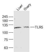 TLR5 Antibody in Western Blot (WB)