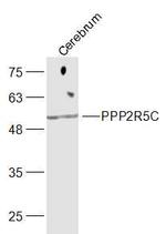 PPP2R5C Antibody in Western Blot (WB)