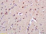AKAP7 Antibody in Immunohistochemistry (Paraffin) (IHC (P))