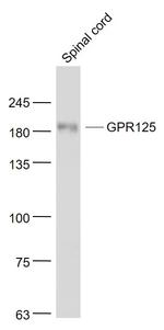 GPR125 Antibody in Western Blot (WB)