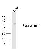 Paralemmin 1 Antibody in Western Blot (WB)