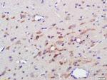 5HT1F Receptor/SR-1F Antibody in Immunohistochemistry (Paraffin) (IHC (P))