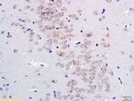 GABRA2/GABA A Receptor alpha 2 Antibody in Immunohistochemistry (Paraffin) (IHC (P))