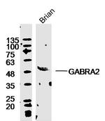 GABRA2/GABA A Receptor alpha 2 Antibody in Western Blot (WB)