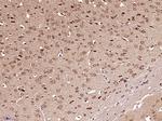 GLI1 Antibody in Immunohistochemistry (Paraffin) (IHC (P))