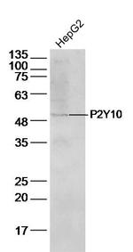 P2Y10 Antibody in Western Blot (WB)