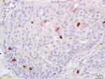 ADAMTS1 Antibody in Immunohistochemistry (Paraffin) (IHC (P))