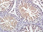 GRINA Antibody in Immunohistochemistry (Paraffin) (IHC (P))
