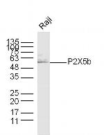 P2X5b Antibody in Western Blot (WB)