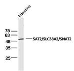 SLC38A2/SNAT2 Antibody in Western Blot (WB)