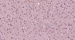 ACCN2 Antibody in Immunohistochemistry (Paraffin) (IHC (P))