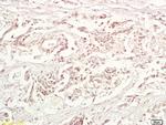 TRAF1 Antibody in Immunohistochemistry (Paraffin) (IHC (P))