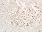 TRAF1 Antibody in Immunohistochemistry (Paraffin) (IHC (P))