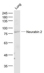 Spinophilin/Neurabin 2 Antibody in Western Blot (WB)