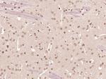 ZNF312 Antibody in Immunohistochemistry (Paraffin) (IHC (P))