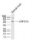 ZNF312 Antibody in Western Blot (WB)