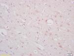 ST18/Znf387 Antibody in Immunohistochemistry (Paraffin) (IHC (P))