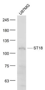 ST18/Znf387 Antibody in Western Blot (WB)