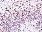 XRCC1 Antibody in Immunohistochemistry (Paraffin) (IHC (P))