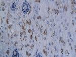 XRCC1 Antibody in Immunohistochemistry (Paraffin) (IHC (P))