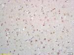 ZNF423/OAZ Antibody in Immunohistochemistry (Paraffin) (IHC (P))