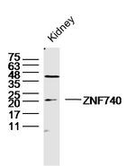 ZNF740 Antibody in Western Blot (WB)