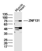 ZNF131 Antibody in Western Blot (WB)