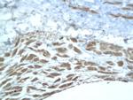 Aggrecan core protein 1 Antibody in Immunohistochemistry (Paraffin) (IHC (P))