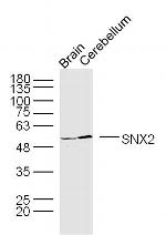 SNX2 Antibody in Western Blot (WB)
