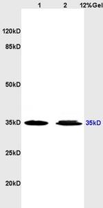 Adenosine A3 Receptor Antibody in Western Blot (WB)