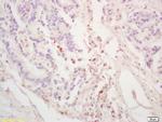 GGNBP2/ZNF403/LCRG1 Antibody in Immunohistochemistry (Paraffin) (IHC (P))
