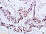 Ack1 Antibody in Immunohistochemistry (Paraffin) (IHC (P))