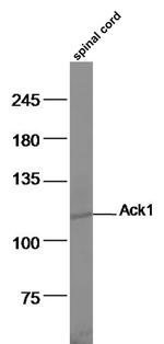 Ack1 Antibody in Western Blot (WB)