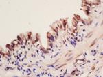 Fox2/RBM9 Antibody in Immunohistochemistry (Paraffin) (IHC (P))
