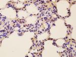 Fox2/RBM9 Antibody in Immunohistochemistry (Paraffin) (IHC (P))