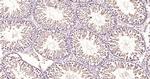 DYRK2 Antibody in Immunohistochemistry (Paraffin) (IHC (P))